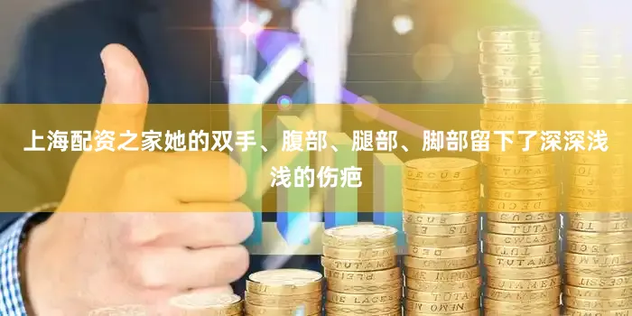上海配资之家她的双手、腹部、腿部、脚部留下了深深浅浅的伤疤